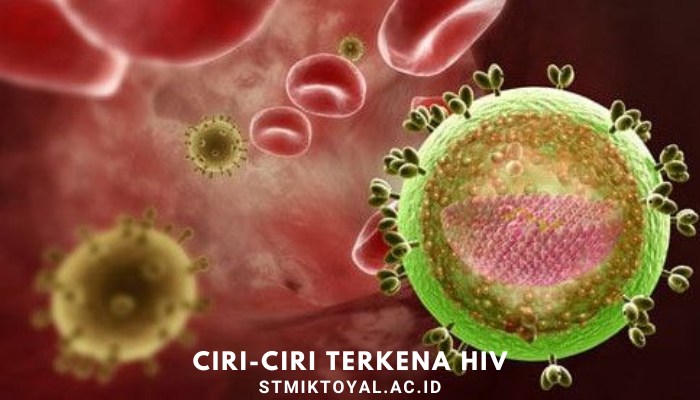 Ciri-Ciri Seseorang Mengalamai Virus Hiv